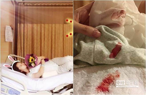 徐若瑄输完液忘记按压针眼 流血1个小时染红毛巾